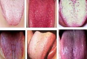 Язык — зеркало организма. Узнай о своих проблемах, чтобы избежать негативных последствий