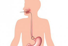 Симптомы основных заболеваний пищевода