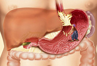Отборная стимуляция роста анаэробной микрофлоры в человеческом кишечном тракте электролизной восстановительной водой