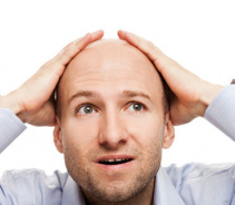 Какие причины вызывают облысение у человека
