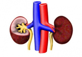 Окислительный стресс, вызванный гемодиализом у больных с терминальной стадией почечной недостаточности