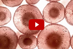 Влияние щелочной воды «Аквалайф» на раковые клетки