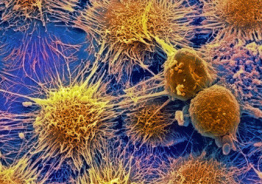 Причины рака