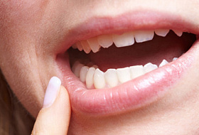 Воспаление десен свидетельствует о болезнях сердца