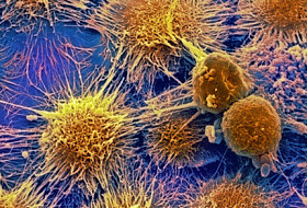 Причины рака