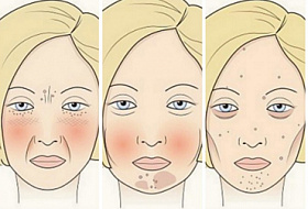 4 продукта, которые портят ваше лицо