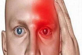 11 опасных симптомов, указывающих на то, что у вас был «тихий» инсульт, и что еще один скоро последует