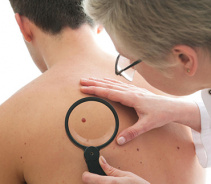 Можно ли самостоятельно удалить висячую родинку